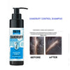 Arfa Cosmetics ANTI DANDRUFF SHAMPOO FOR CONTROLLING DANDRUFF HAIR LOSS ALL HAIR TYPES USE 100 ML