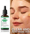 Arfa Cosmetics Pack OF 3 Whitening Serum PORE REFINING Serum Niacinamide & Glycolic Acid Salicylic Acid Anti Acne Serum FREE DELIVERY