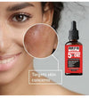 Arfa Cosmetics Hot Deal Urgent Facial  5IN1 Serum Gulatathione Brighten Skin Tone Removes Dead Skin Hyaluronic Vitamin c All Skin Types Use