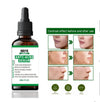 Arfa Cosmetics Pack OF 3 Whitening Serum PORE REFINING Serum Niacinamide & Glycolic Acid Salicylic Acid Anti Acne Serum FREE DELIVERY