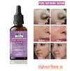Arfa Cosmetics Pack OF 3 Whitening Serum PORE REFINING Serum Niacinamide & Glycolic Acid Salicylic Acid Anti Acne Serum FREE DELIVERY
