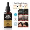 Arfa Cosmetics  Hair Growth Kit  Hair Growth Vitalizer Minixodil Spray  Hair growth Serum  Hair Care Products All hairs types use