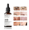 Arfa Cosmetics Premium Niacinamide 10% + Zinc 1%  Glowing Skin Dark Spots Brightening Oil Contro Serum 30ml for All Skin Types 30ML