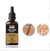 Arfa Cosmetics Anti Hair Loss Hair Regrowth Oil Serum Hair Hair Growth Hair Lengthening Serum Hair Care  All Hair Types Use 30Ml